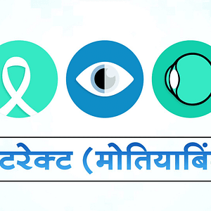 Cataract Patient Education Video in different languages